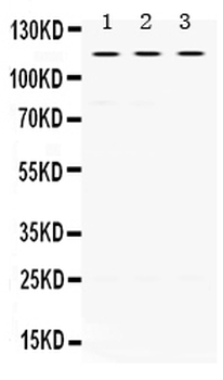 UNC5C Rabbit Polyclonal Antibody