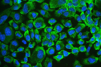 RENT1/hUPF1 Rabbit Polyclonal Antibody