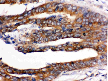 RENT1/hUPF1 Rabbit Polyclonal Antibody