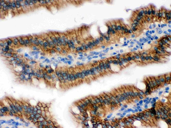 RENT1/hUPF1 Rabbit Polyclonal Antibody