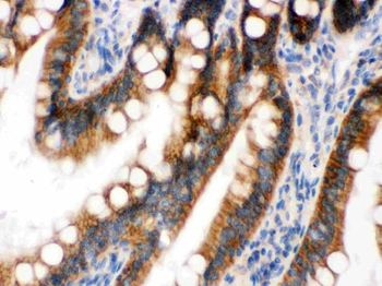 RENT1/hUPF1 Rabbit Polyclonal Antibody