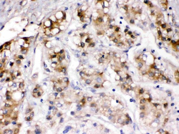 Ceruloplasmin/CP Rabbit Polyclonal Antibody
