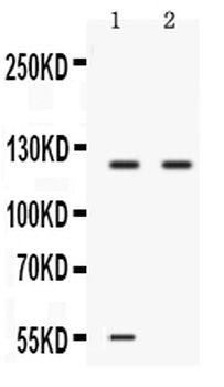 Ceruloplasmin/CP Rabbit Polyclonal Antibody