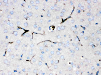 Ceruloplasmin/CP Rabbit Polyclonal Antibody