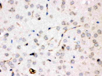 Ceruloplasmin/CP Rabbit Polyclonal Antibody