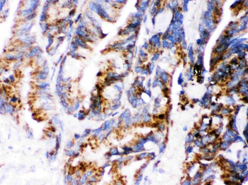 Cathepsin D/CTSD Rabbit Polyclonal Antibody