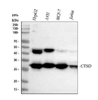 Cathepsin D/CTSD Rabbit Polyclonal Antibody