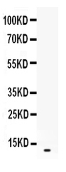 CXCL2 Rabbit Polyclonal Antibody