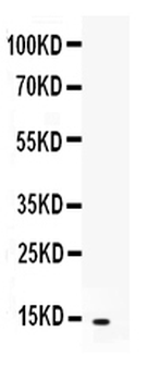 CXCL5 Rabbit Polyclonal Antibody