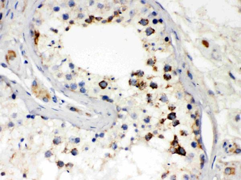 Smac/Diablo Rabbit Polyclonal Antibody