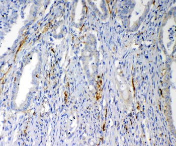 VEGFD/FIGF Rabbit Polyclonal Antibody