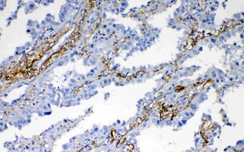 VEGFD/FIGF Rabbit Polyclonal Antibody
