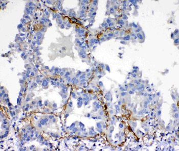 VEGFD/FIGF Rabbit Polyclonal Antibody