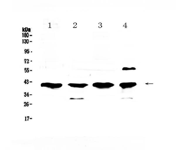 VEGFD/FIGF Rabbit Polyclonal Antibody