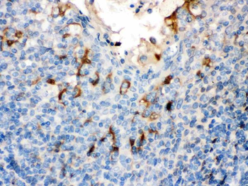 Filaggrin/FLG Rabbit Polyclonal Antibody