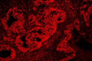 nmt55/p54nrb/NONO Rabbit Polyclonal Antibody