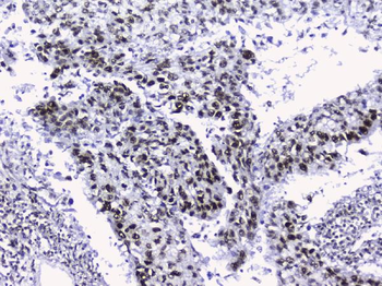 nmt55/p54nrb/NONO Rabbit Polyclonal Antibody