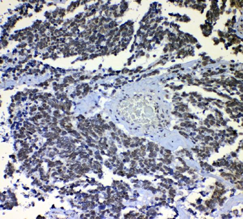 nmt55/p54nrb/NONO Rabbit Polyclonal Antibody