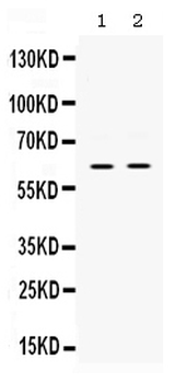 PAK3 Rabbit Polyclonal Antibody