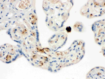 NAP2/PPBP Rabbit Polyclonal Antibody