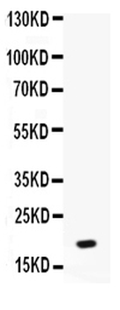 NAP2/PPBP Rabbit Polyclonal Antibody