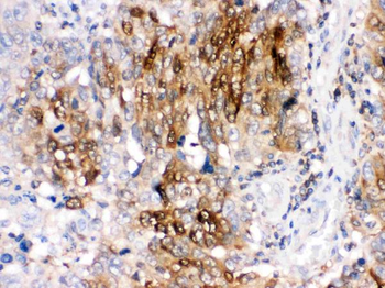 DARPP32/PPP1R1B Rabbit Polyclonal Antibody