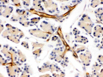 DARPP32/PPP1R1B Rabbit Polyclonal Antibody