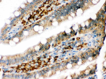 DARPP32/PPP1R1B Rabbit Polyclonal Antibody
