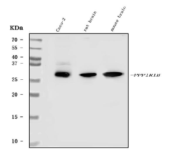 DARPP32/PPP1R1B Rabbit Polyclonal Antibody