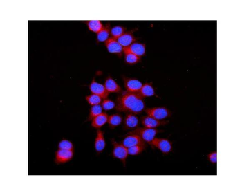 RAB7/RAB7A Rabbit Polyclonal Antibody
