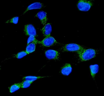 RAB7/RAB7A Rabbit Polyclonal Antibody