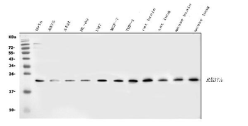 RAB7/RAB7A Rabbit Polyclonal Antibody