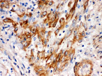 SFRP4 Rabbit Polyclonal Antibody