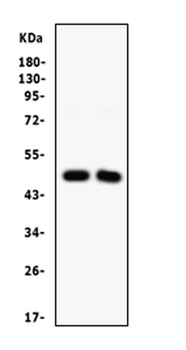 SFRP4 Rabbit Polyclonal Antibody