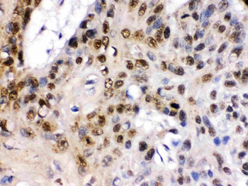 TCF7L1 Rabbit Polyclonal Antibody