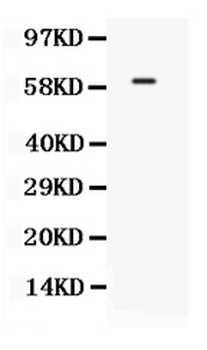 TCF7L1 Rabbit Polyclonal Antibody