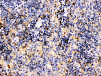 TRIB2 Rabbit Polyclonal Antibody