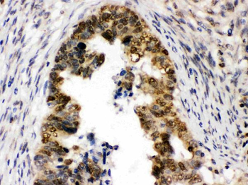 UHRF1 Rabbit Polyclonal Antibody