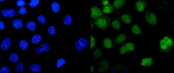 ZBTB7A Rabbit Polyclonal Antibody