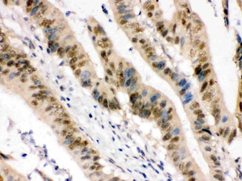 ZBTB7A Rabbit Polyclonal Antibody