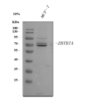 ZBTB7A Rabbit Polyclonal Antibody
