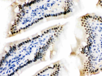 ZBTB7A Rabbit Polyclonal Antibody