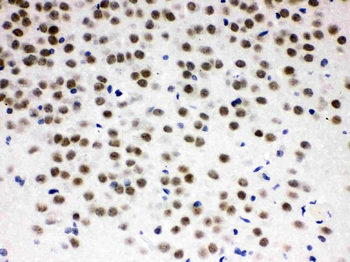 ZBTB7A Rabbit Polyclonal Antibody