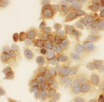 SIAH Interacting Protein/CACYBP Rabbit Polyclonal Antibody