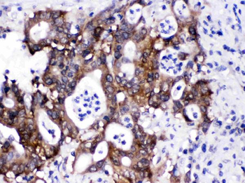 SIAH Interacting Protein/CACYBP Rabbit Polyclonal Antibody
