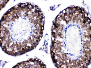 SIAH Interacting Protein/CACYBP Rabbit Polyclonal Antibody