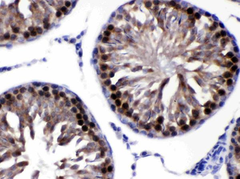 SIAH Interacting Protein/CACYBP Rabbit Polyclonal Antibody
