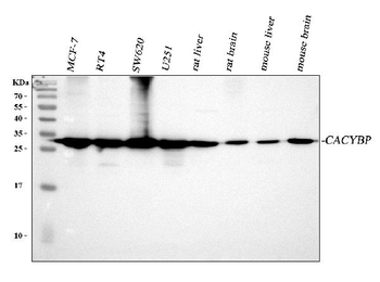 SIAH Interacting Protein/CACYBP Rabbit Polyclonal Antibody