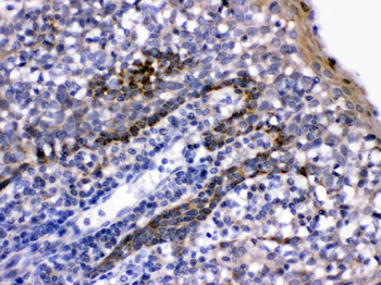 LFA3/CD58 Rabbit Polyclonal Antibody