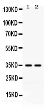 LFA3/CD58 Rabbit Polyclonal Antibody